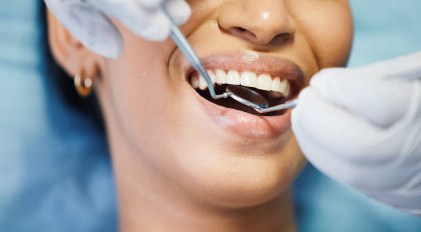 Best Emergency Gum Treatment in Kelso, WA