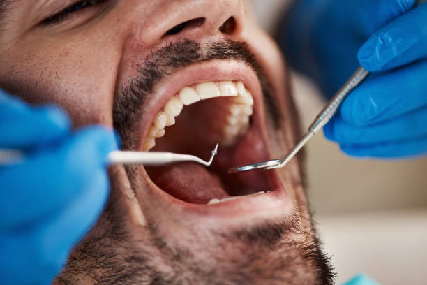 Best Emergency Treatment for Dental Infections or Abscesses in Kelso, WA